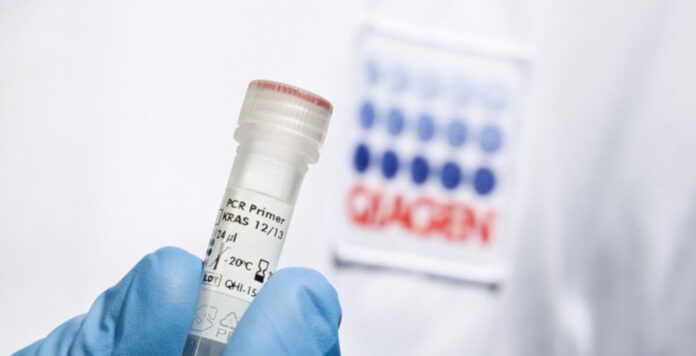 Qiagen ist mit gleich mehreren Kaufinteressenten im Gespräch. Die Übernahmefantasien beflügeln den Aktienkurs.