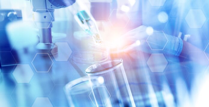 Exit via IPO: Der Finanzinvestor Cinven will die Laborkette Synlab noch im ersten Halbjahr 2021 an die Börse bringen.